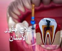 مطلوب فوررا وعاجل اخصائى علاج جذور اسنان   لمجمع متميز بالسعودية  